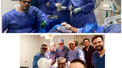 عملية ناجحة ليد مبتورة الحركة بجامعة المنوفية باستخـدام تقنيـة الميكروسكـوب الجراحـي  