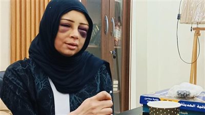 فيديو اعتداء يهز بورسعيد.. ضبط شاب هاجم خطيبته السابقة داخل الكوافير