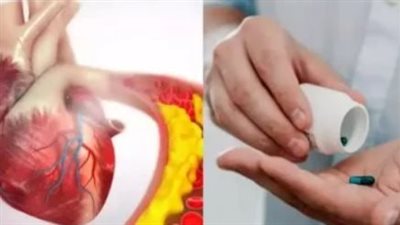 هل تعاني من ارتفاع الكوليسترول؟ تعرف على الأسباب والأعراض والحلول العلمية