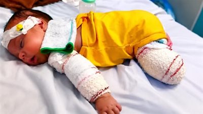 حكاية الرضيع محمد الخطيب ومعركة البقاء
