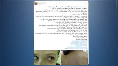 الأمن يكشف حقيقة التعدي على طفلة بالضرب في الدقهلية.. وضبط الأب والنيابة تتدخل