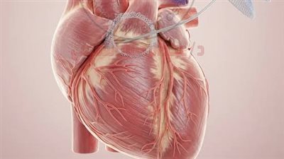 وزارة الصحة توضح طرق الوقاية من تكرار جلطات القلب بعد التعافي