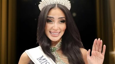 غيرت مقاييس الجمال.. مصرية مصابة بالبهاق تشارك في مسابقة ملكة جمال الكون