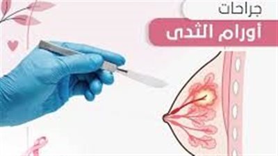 جراحات الثدي.. الصحة تطلق مبادرة صحة المرأة
